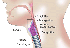 Carcinoma of the Larynx 